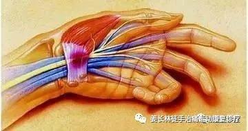 日常生活中的疼痛1—手麻(长时间玩手机)的判断和自我纠正