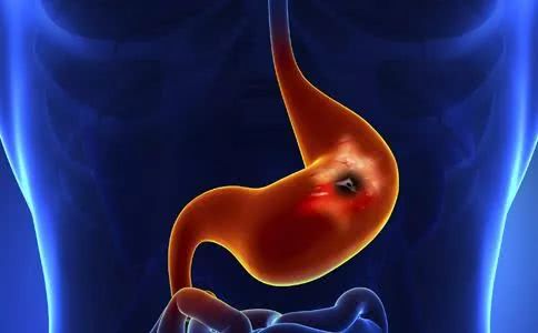 90岁老人不吃不喝为什么还有大便,90岁老人忽然不吃不喝不说话