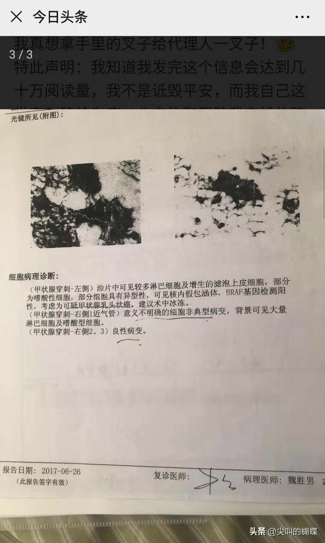 保险可以保甲状腺癌吗,甲状腺癌保险可以保吗