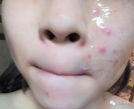 芦荟胶的正确用法：不是“直接”涂！方法弄错了，难怪会没有效果