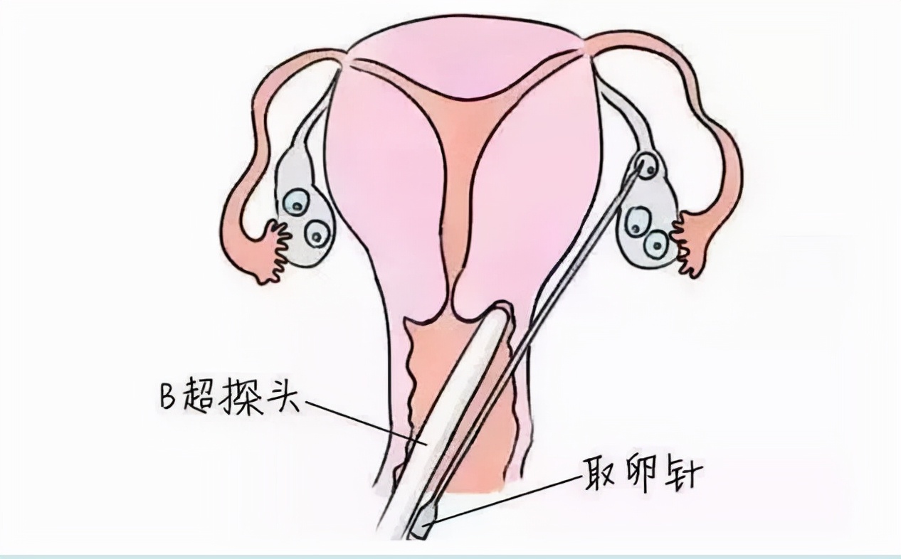 取很多卵为什么优质的少,为什么取的卵比实际的卵少