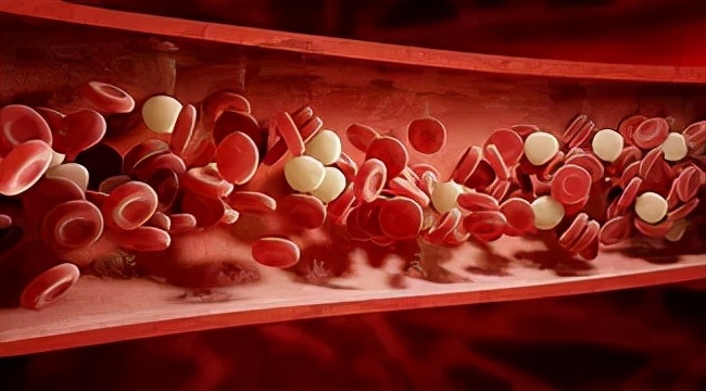 颅内海绵状血管瘤能治好吗,什么是颅内海绵状血管瘤