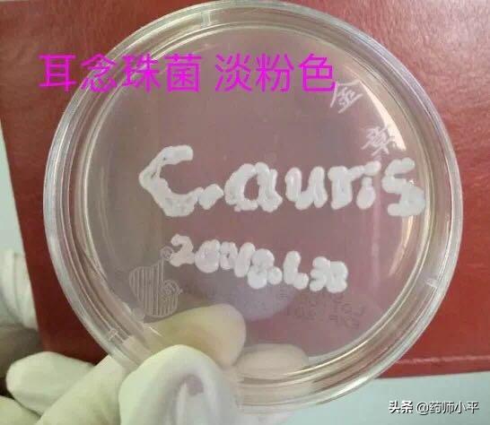 美国真菌感染死亡人数,美国超级真菌感染的症状