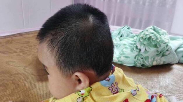 7个月的宝宝头睡扁了还能纠正吗,60天的婴儿后脑勺扁怎么矫正