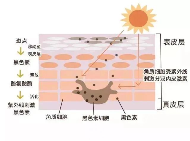 黑眼圈分几种怎么治,黑眼圈的种类和解决办法