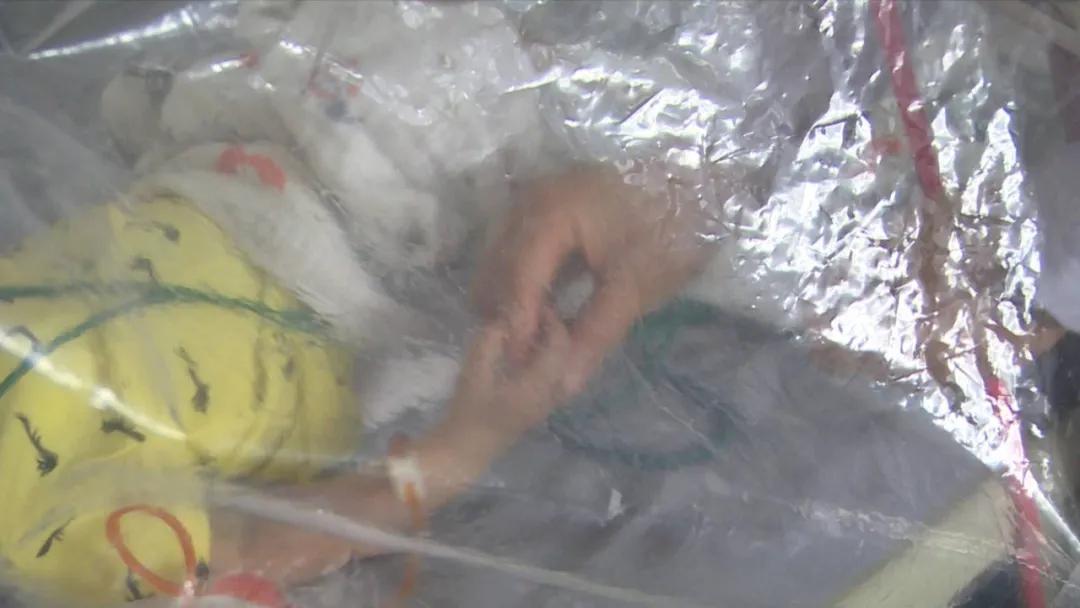 徐州儿童医院治疗血骨瘤,徐州儿童医院血液科怎么样