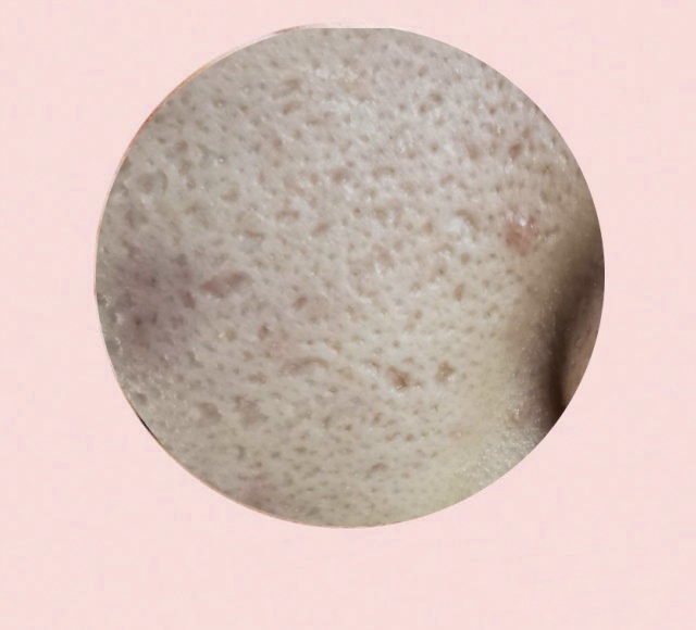 油皮毛孔粗大毛孔多要怎么改善,油皮毛孔粗大护肤品