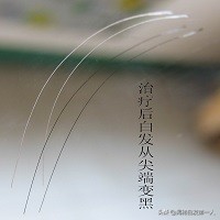 鼻涕是怎么形成的,为什么会流清鼻涕和眼泪