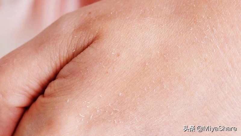 用化妆品搓泥怎么解决,化妆品搓泥严重怎么解决