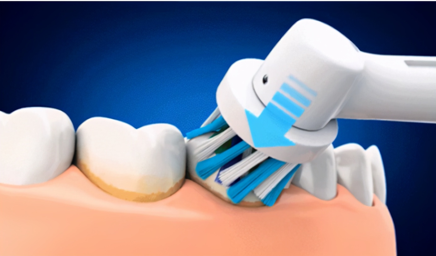 意大利银卫士牙刷,口腔清道夫电动牙刷