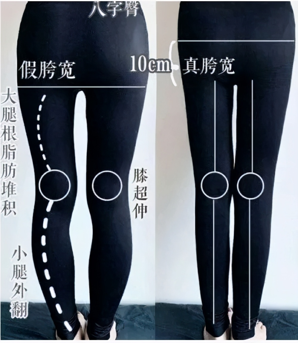 假胯宽骨盆矫正的正确方法,改善假胯宽收紧骨盆的私教课程