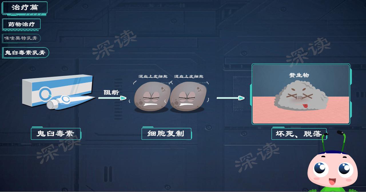 液氮冷冻治疗尖锐湿疣,冷冻和激光治疗尖锐湿疣的效果