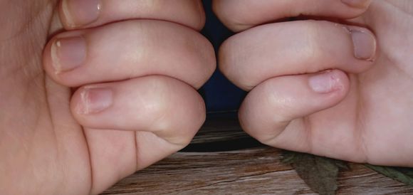 孩子咬手指甲抠指甲是什么原因,孩子咬指甲抠指甲