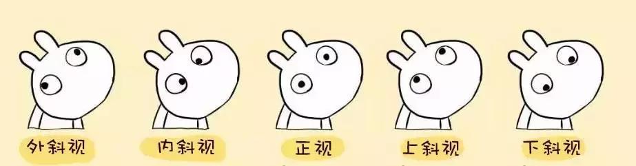 如何分辨斜视的眼睛,怎么分辨眼睛有没有斜视