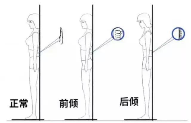 右侧骨盆前倾的最有效的矫正方法,下交叉综合症骨盆前倾矫正