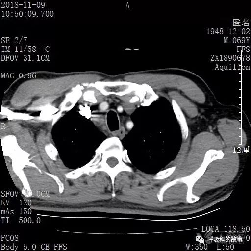怎么应用统计学做调查,统计学方法可以解决的主要问题