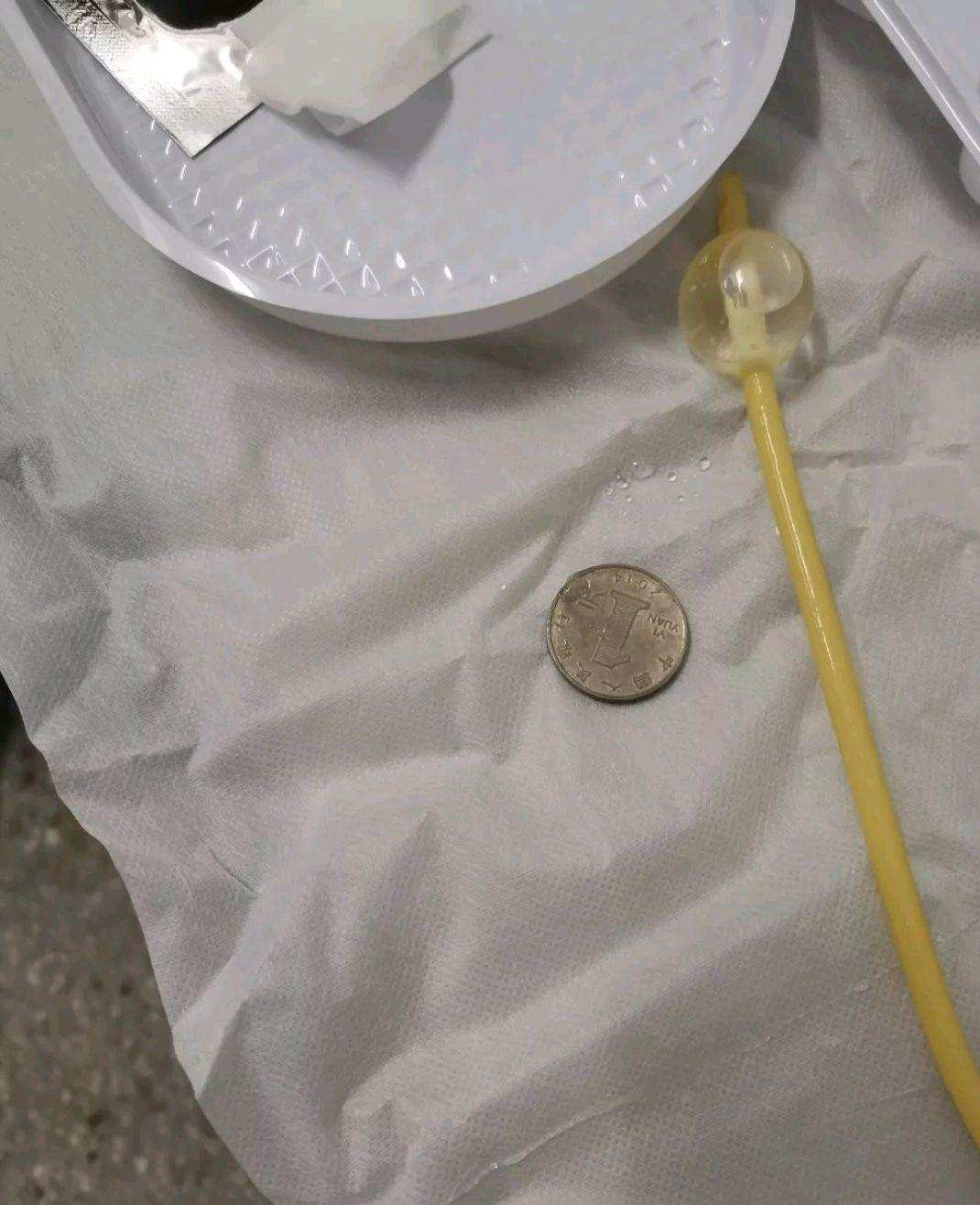 误吃硬币应怎么处理,小孩误吃硬币了怎么办