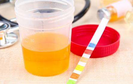 尿酸高5个点严重吗,尿酸居高不下经常做三个动作