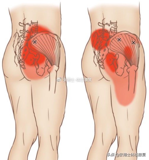 功能训练臀多久练一次,功能训练臀腿