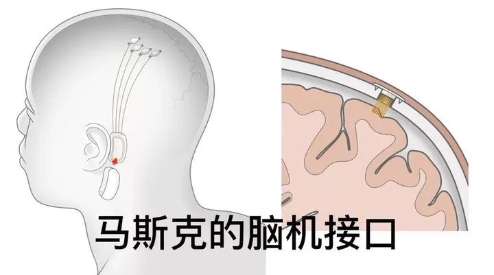 未来马斯克最新机器人,马斯克宣布脑机接口患者恢复