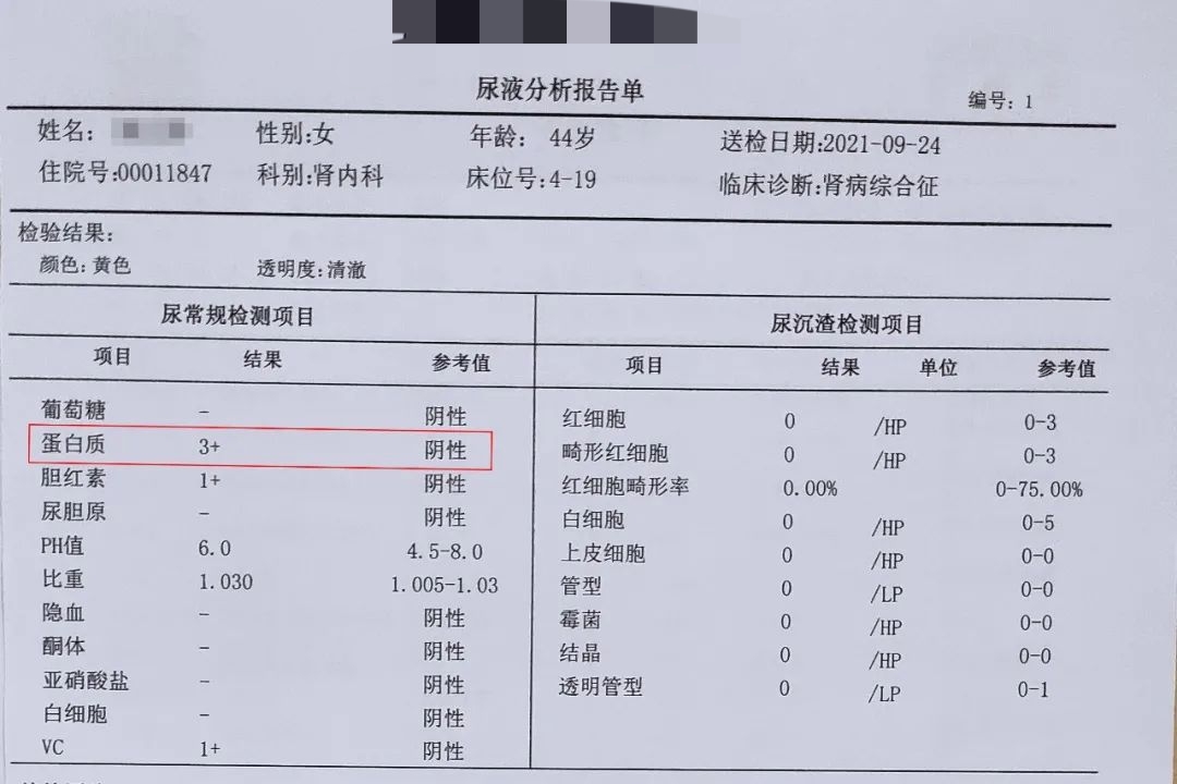 尿蛋白1+会是严重肾炎吗,尿蛋白1+肾功能正常