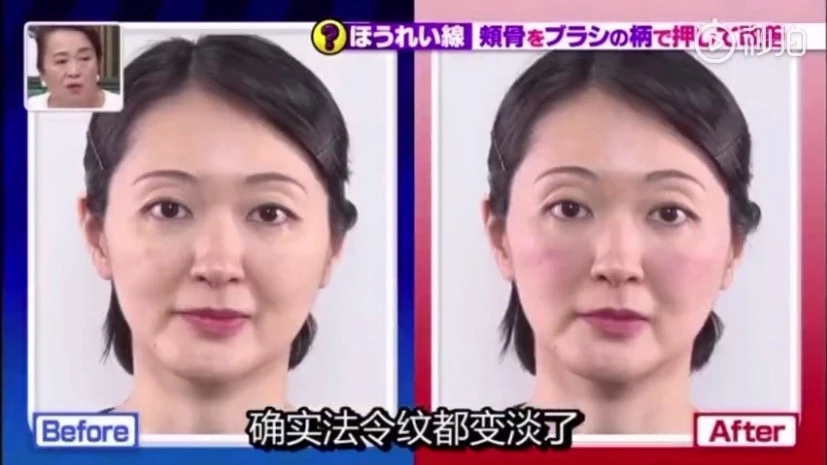 二十几岁法令纹特别明显是为什么,为什么比同龄人法令纹特别重