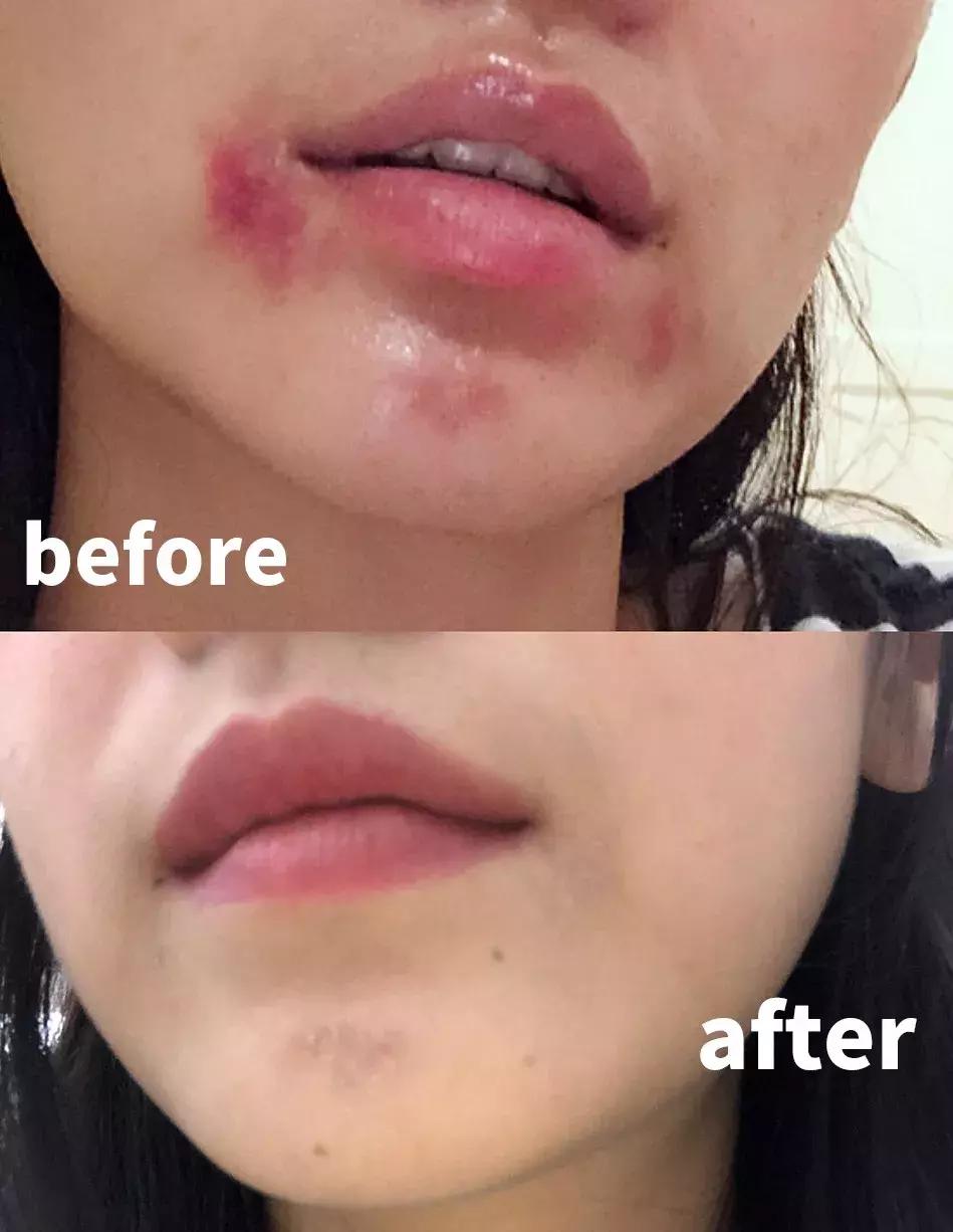 医美爆款面膜,公认最好用的10大网红面膜