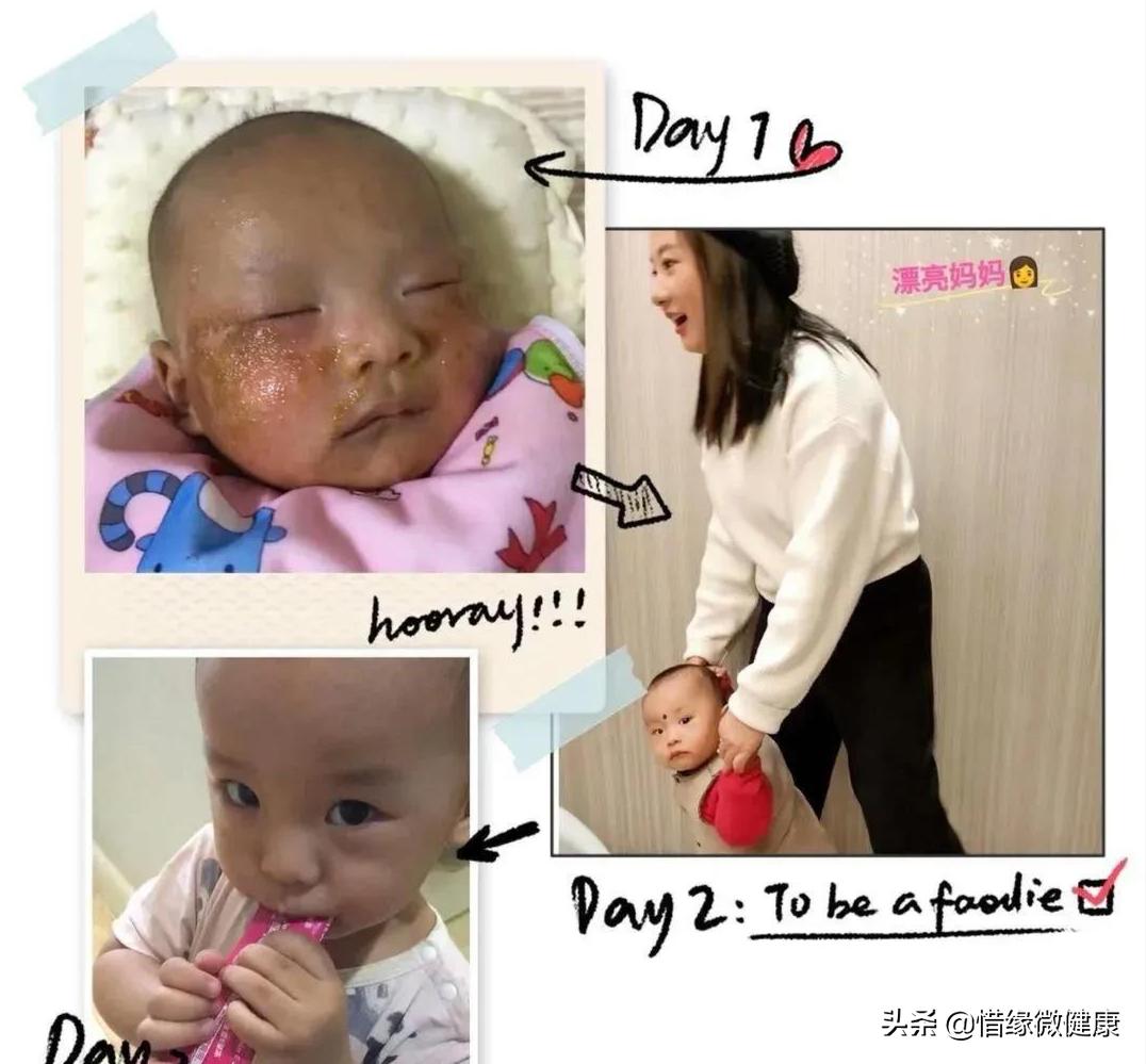 10年湿疹治不好怎么办,10年皮肤病无法根治怎么办