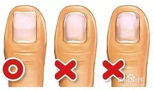 预防糖尿病足发生的正确方法,足部健康养生一切从脚开始