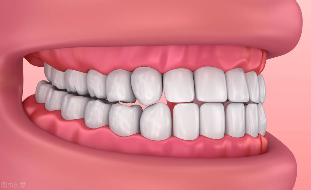 种植牙与假牙区别,种植牙安全可靠吗