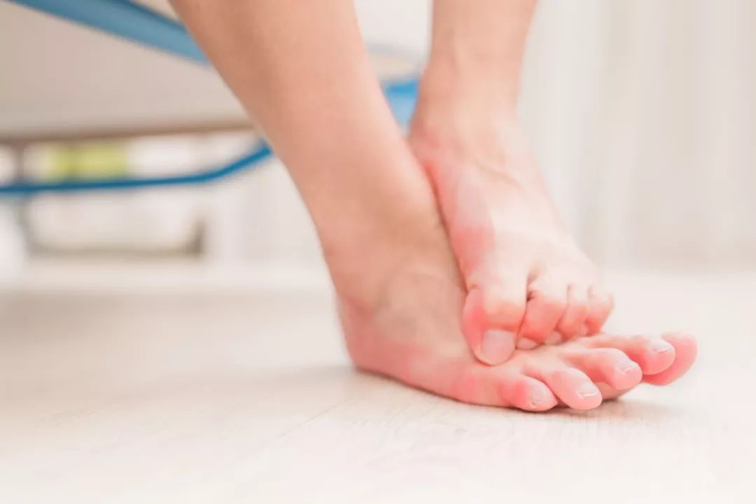 女冬天手脚冰凉长冻疮什么原因,长筒靴会冻疮吗