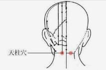 落枕了教你落枕的正确处理方法,落枕怎么办教你三个动作