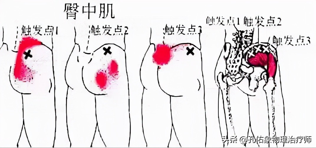 臀部疼痛腿麻怎么治疗效果好,臀部腰疼痛怎么回事