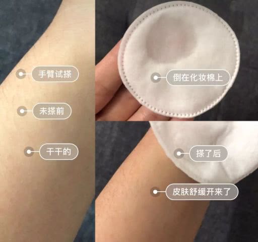 淡斑祛痘印什么产品最有效,淡斑美白祛痘印