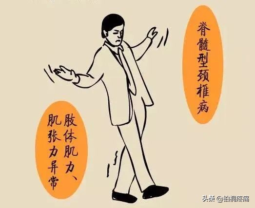 颈椎病疼痛怎么办缓解疼痛,得了颈椎病怎样治疗才最好治