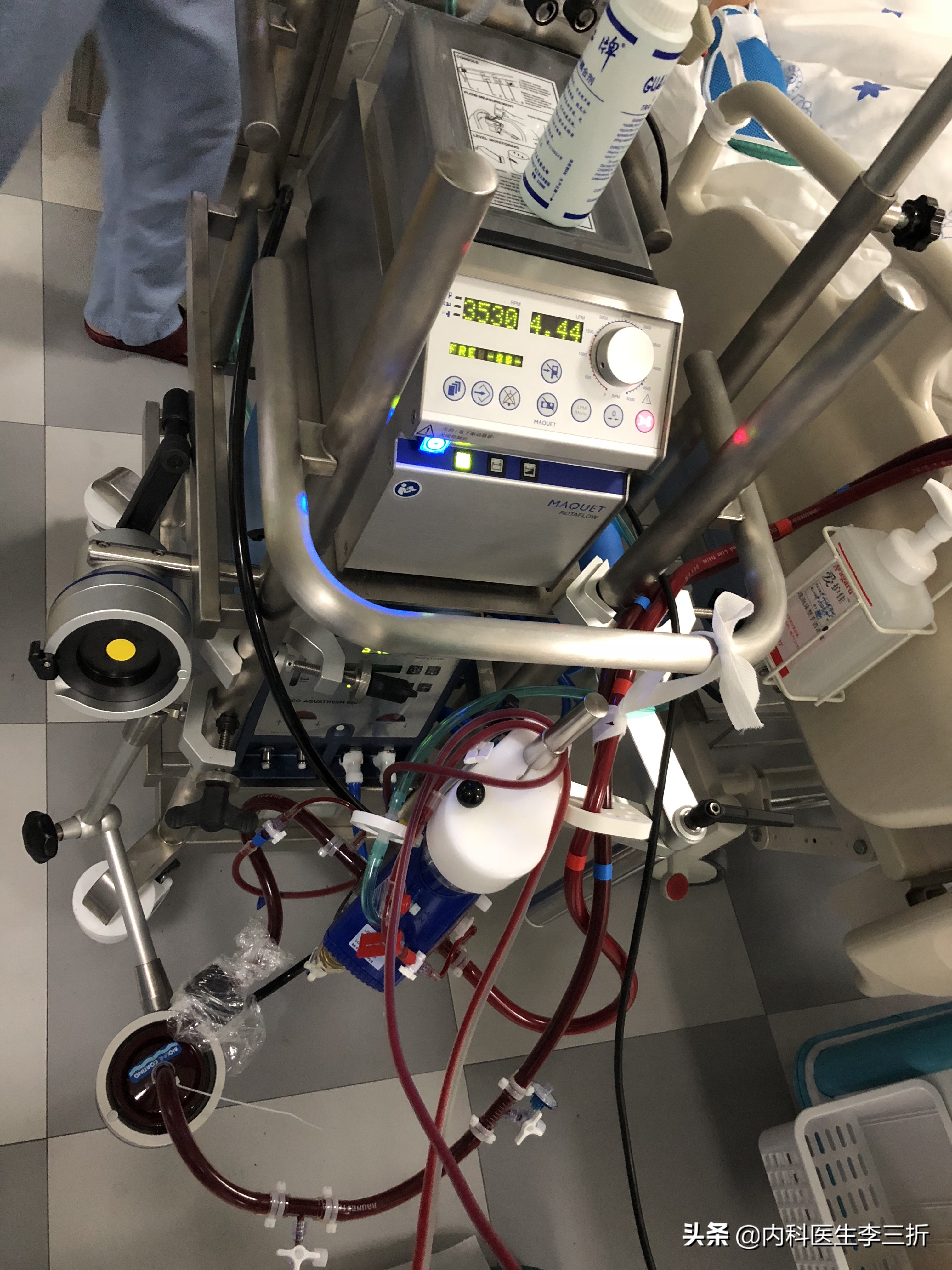 辅助心脏功能的机器,能代替心脏和肺的机器