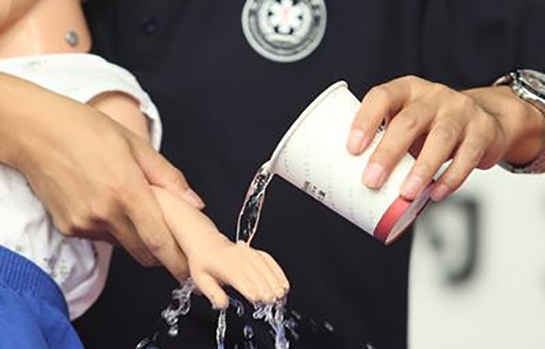 宝宝受伤正确处理方法get,小孩意外受伤注意事项