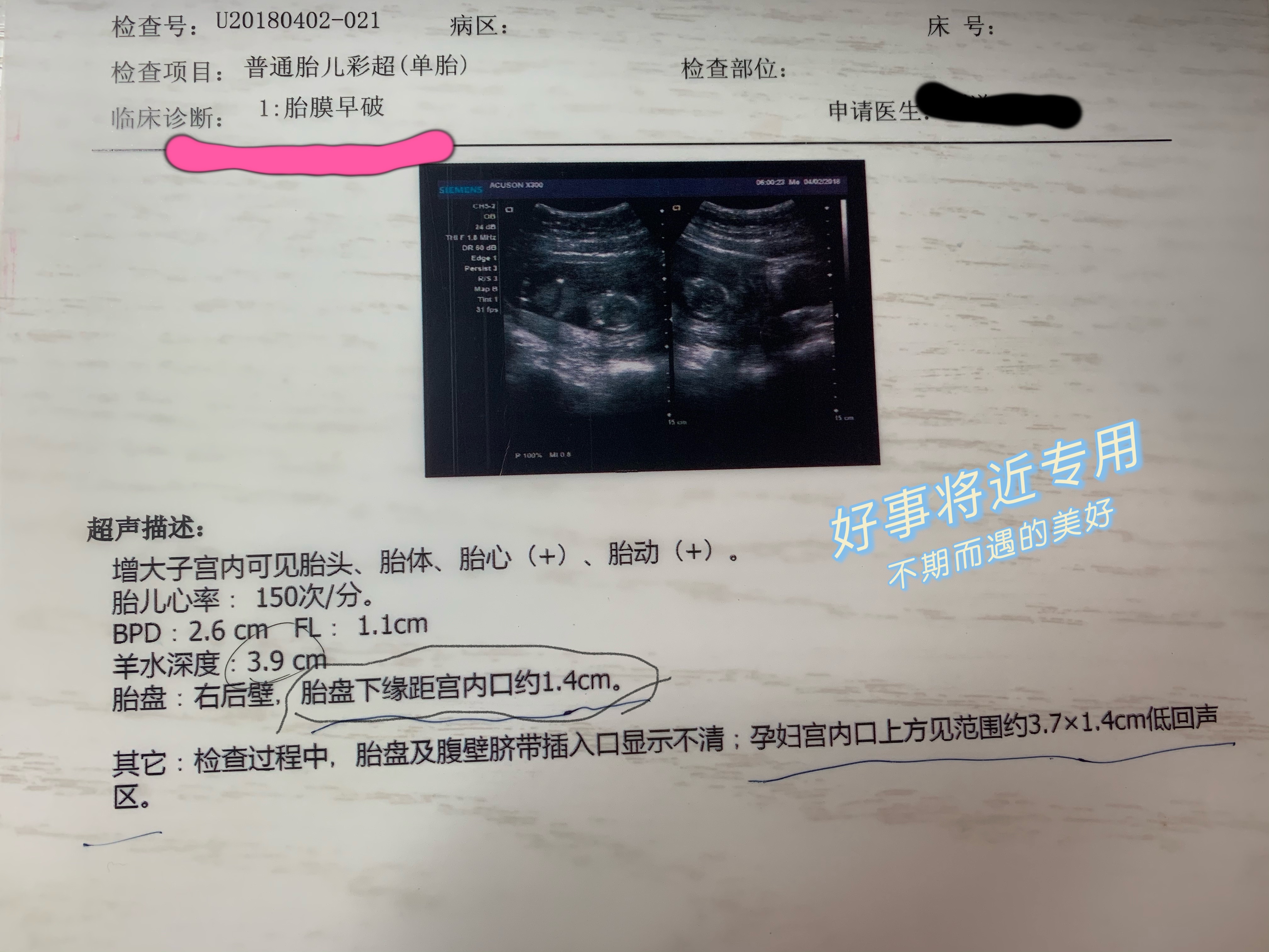 怀孕16周羊水破了见红能否保胎,26周羊水早破保胎成功几率