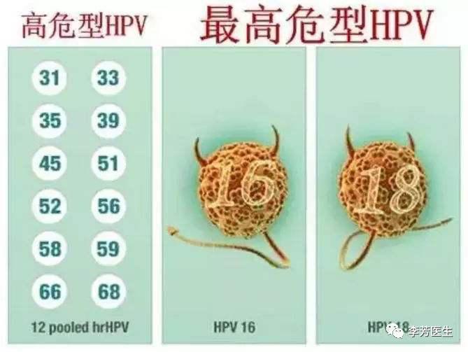 专家谈hpv感染,名医在线hpv