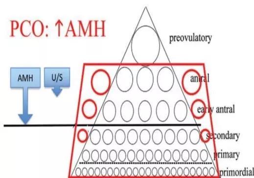 AMH11，是传说中的多囊吗？AMH只有0.06，是快要绝经了么？