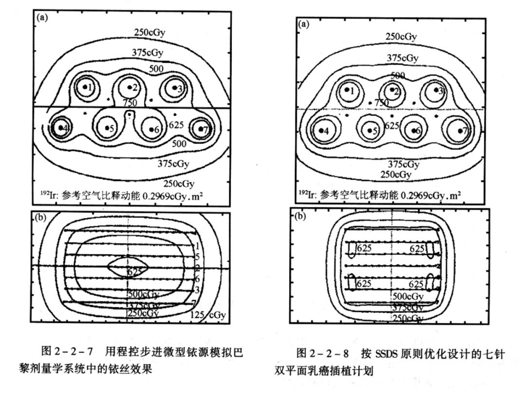 近距离放疗的副作用,近距离放疗