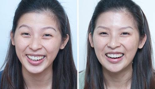 戚薇力荐的眼霜,用后黑眼圈细纹都没了,李佳琦:确实不错