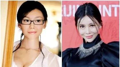 美女野兽肉毒素：你是在微美还是在危美？