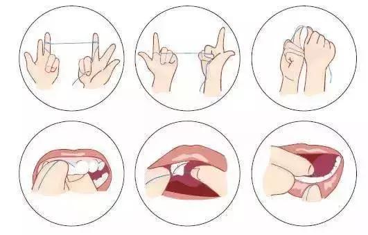 牙签不靠谱，谁才是真正的护牙神器？