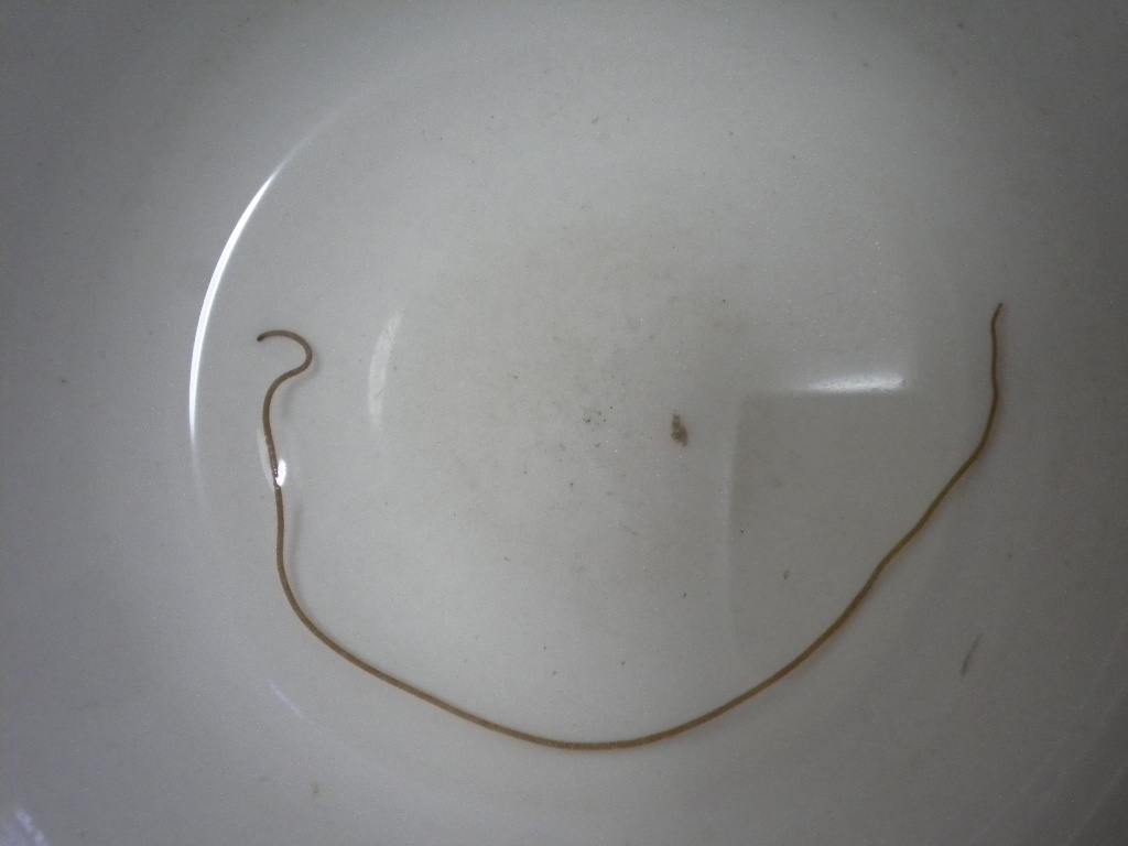 钓上来的鱼全身寄生虫,野钓鱼长寄生虫