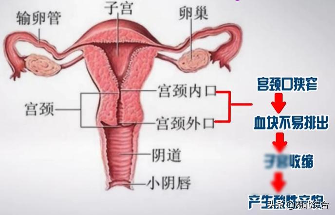 经常痛经,其实是血块堵住了!必须赶紧改掉六个坏习惯