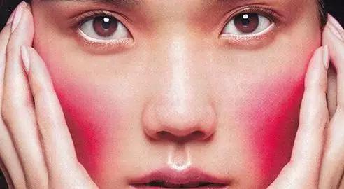 红血丝的四个雷区,关于红血丝你必须知道的几件事