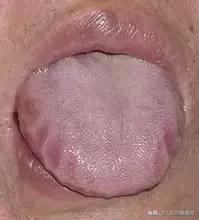 西洋参吃多了有副作用,西洋参吃多了会怎样