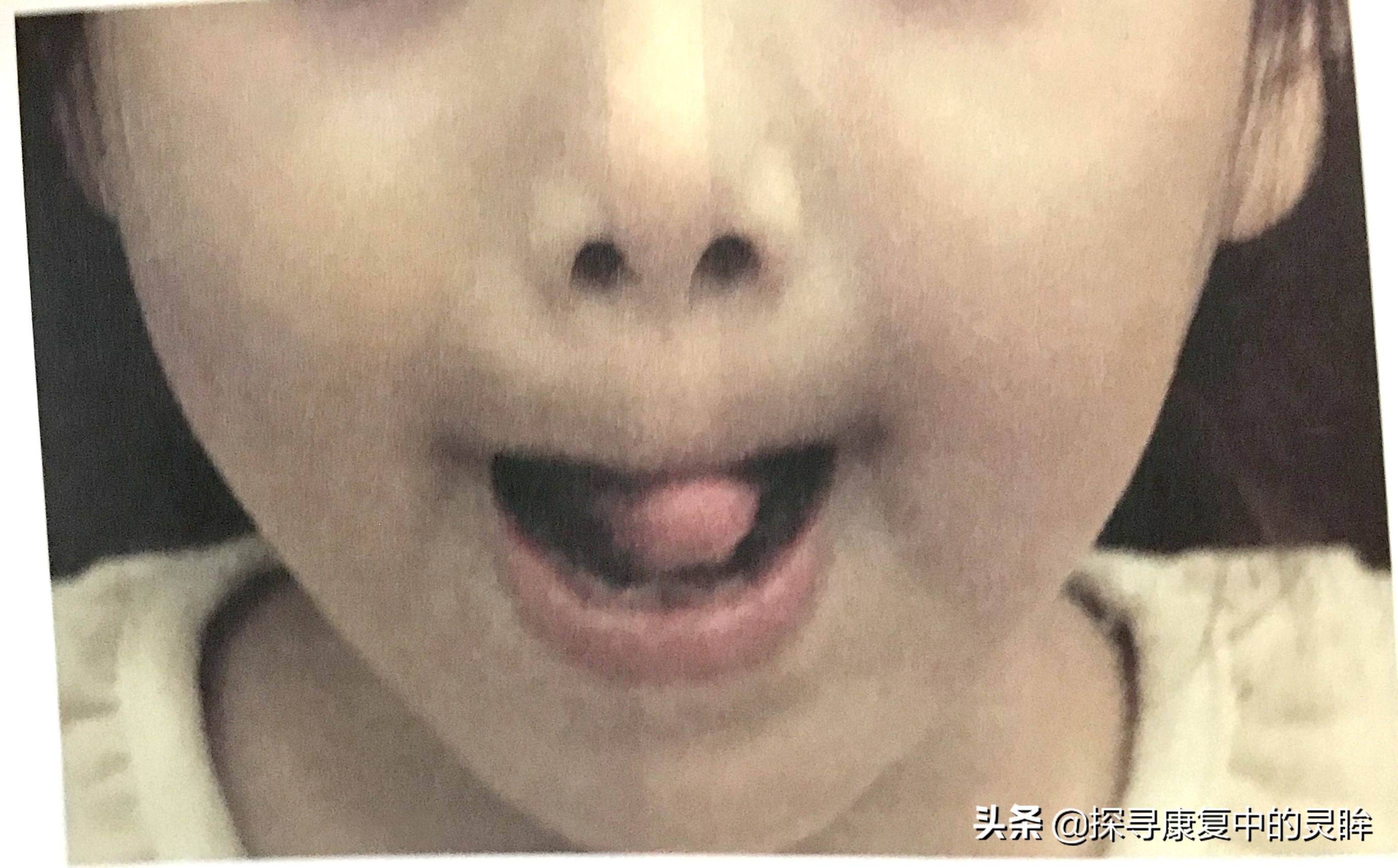 五种口部运动：灵活孩子的樱桃小嘴，让他们说话更清晰（超简单）