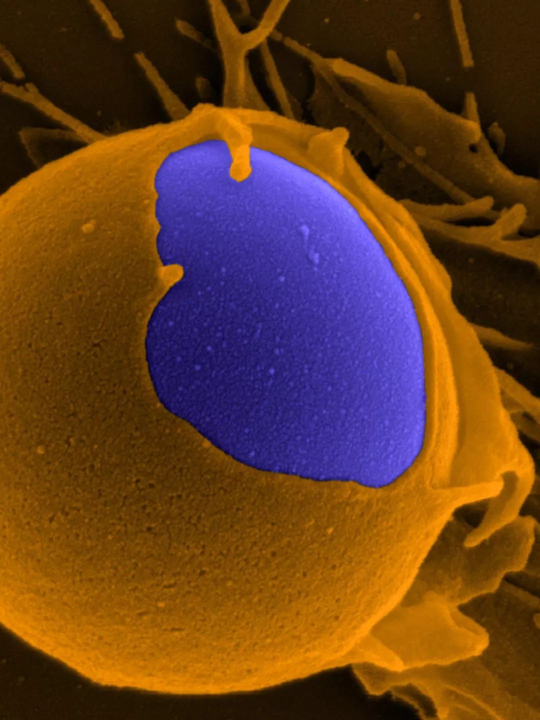 人体防卫战,人体痛点攻击技巧